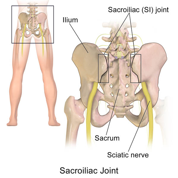 Sacroiliac Joint Injection